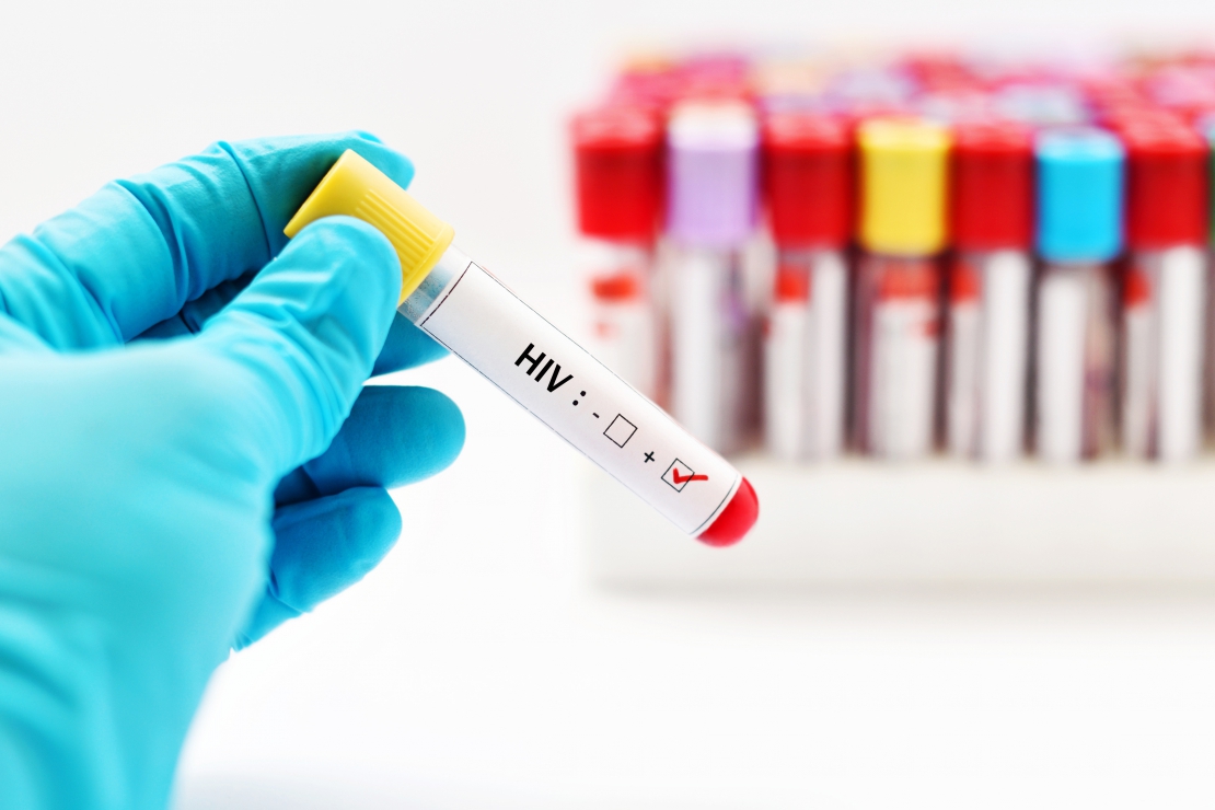 Casos de Aids avançam entre jovens e aumentam 90% no Vale em 10 anos
