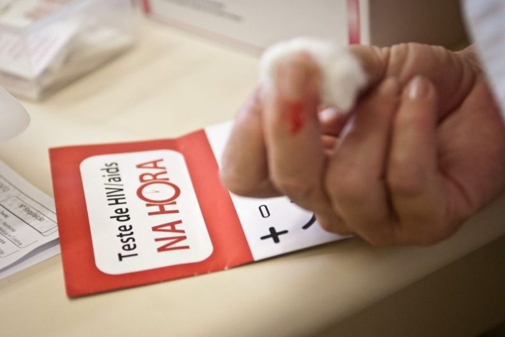 Vale do Paraíba registra queda de 56% nos casos de Aids