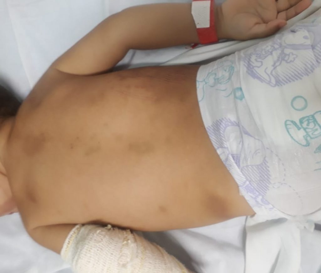 Polícia investiga violência contra criança de 2 anos em Caraguatatuba