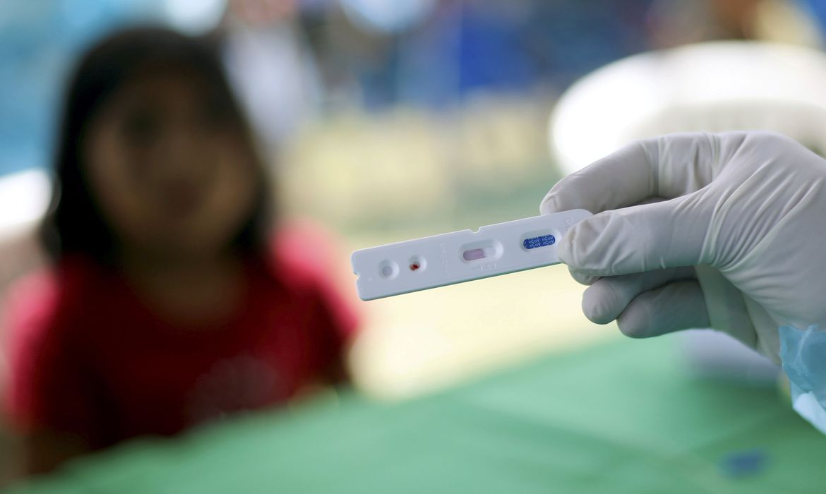 São José dos Campos registra mais 578 casos e 13 óbitos em decorrência da Covid-19