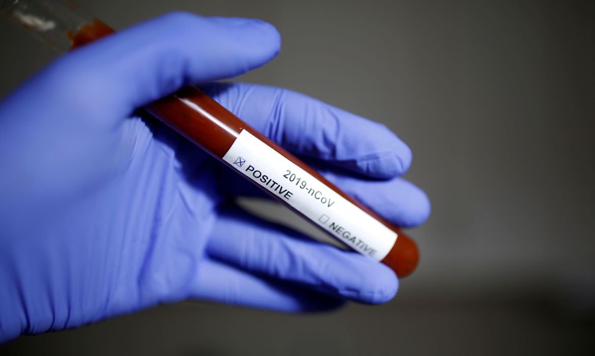 São Paulo confirma primeiro caso de reinfecção por Covid-19 no estado