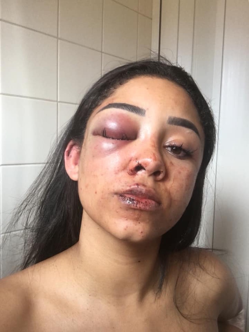 Homem acusado de agressão vai a júri popular em São José dos Campos