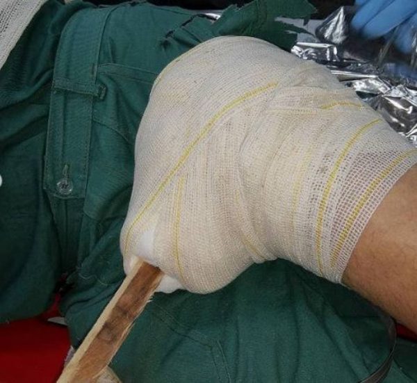 Homem ferido com pedaço de madeira é resgatado pelo Águia