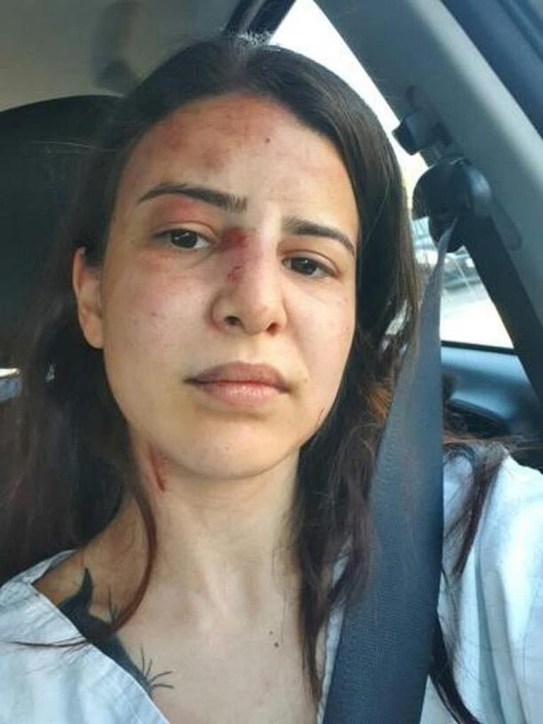 Júri condena homem que golpeou ex-esposa com tesouradas a oito anos de prisão em São José dos Campos