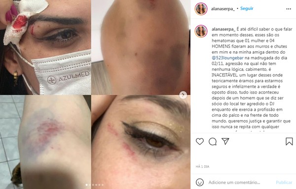 Polícia Civil investiga agressão a mulher em bar em São José dos Campos