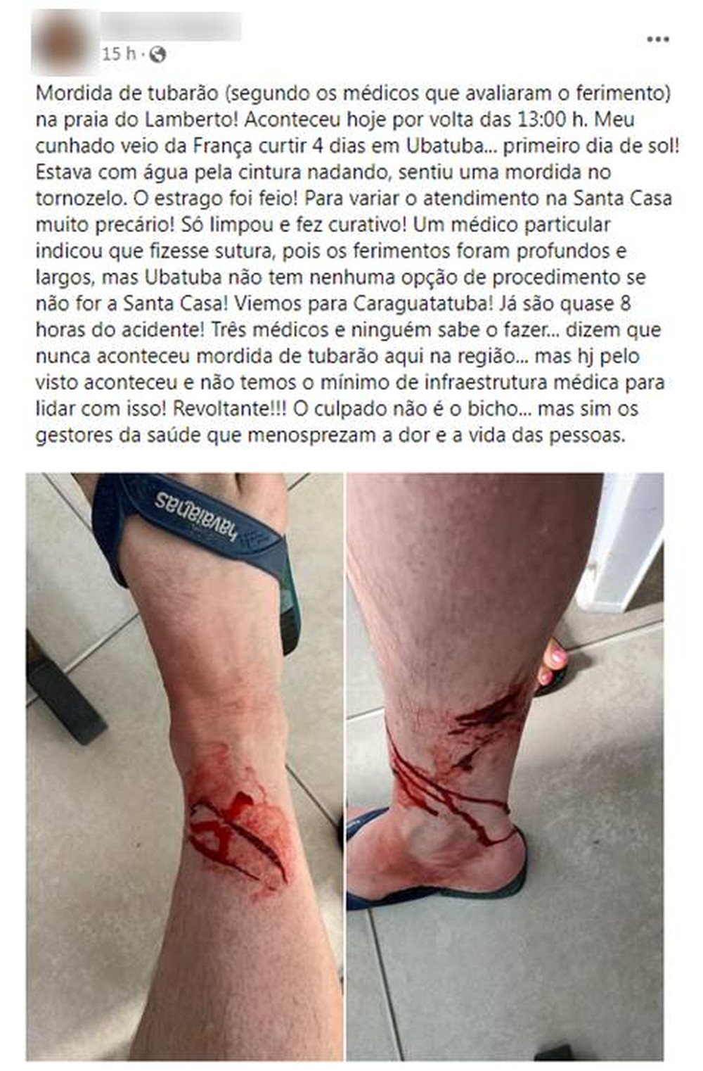 Instituto Argonauta confirma ataque de tubarão na praia do Lamberto em Ubatuba
